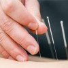 Centro de Salud ofrece un Método Holístico para Perder Peso
