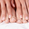 Las Uñas y la Salud: Lea las Señales