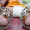 Miracle Foot Doctor