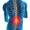 Rush Experts Discuss Advancement in Treatments at Free Program
