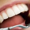 Take Care of Your Teeth