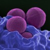 Diabetes May Raise Your Risk of Staph Infections