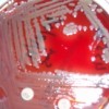 Cluster of Elizabethkingia Cases Identified In Illinois
