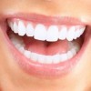 New Year, New Smile