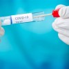 Community-Based COVID-19 Testing Sites to End Operations