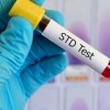El Condado de Cook Pide Hacerse Pruebas para las dos STDs más Comunes