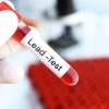 Rep. García, Senators Durbin Introduce Bipartisan Legislation to Protect Children from Lead Poisoning