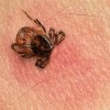 IDPH Reminds Illinois Residents to Take Precautions Against Tick Bites