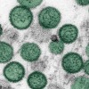 Hantavirus Information for Chicagoans