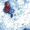 Cyclospora in Illinois Rises