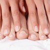 Nails and Health: Read the signs
