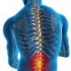 Octubre Mes de Concientización de la Salud de la Espina Dorsal