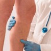 Free Vein Screening to be offered by USA Vein Clinics