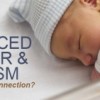 Inducing Labor Doesn’t Increase Autism Risk, Study Suggests