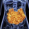 Imbalance in Gut Bacteria May Link to Chronic Fatigue Syndrome