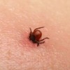 What To Do If You Get a Tick Bite