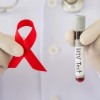 Know Your Status: ‘GTZ-IL to end HIV epidemic by 2030’