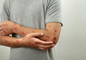 Lawndale News Chicago's Bilingual Newspaper - Health