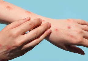 Lawndale News Chicago's Bilingual Newspaper - Health